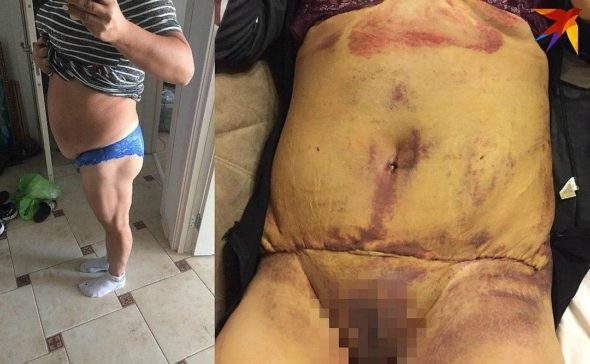 Алёна Верди, пациенты